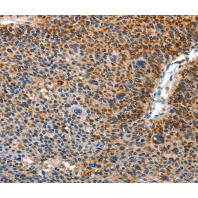 Immunohistochemistry - AMDHD2 Antibody from Signalway Antibody (36092) - Antibodies.com