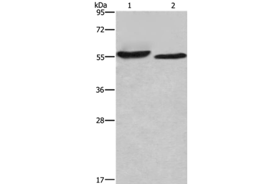 AMIGO2 Antibody from Signalway Antibody (36094) - Antibodies.com