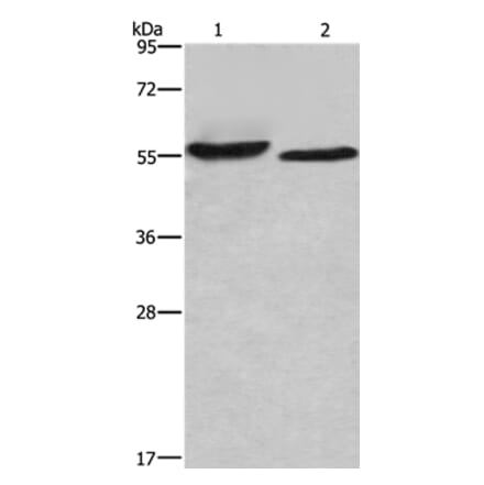 AMIGO2 Antibody from Signalway Antibody (36094) - Antibodies.com