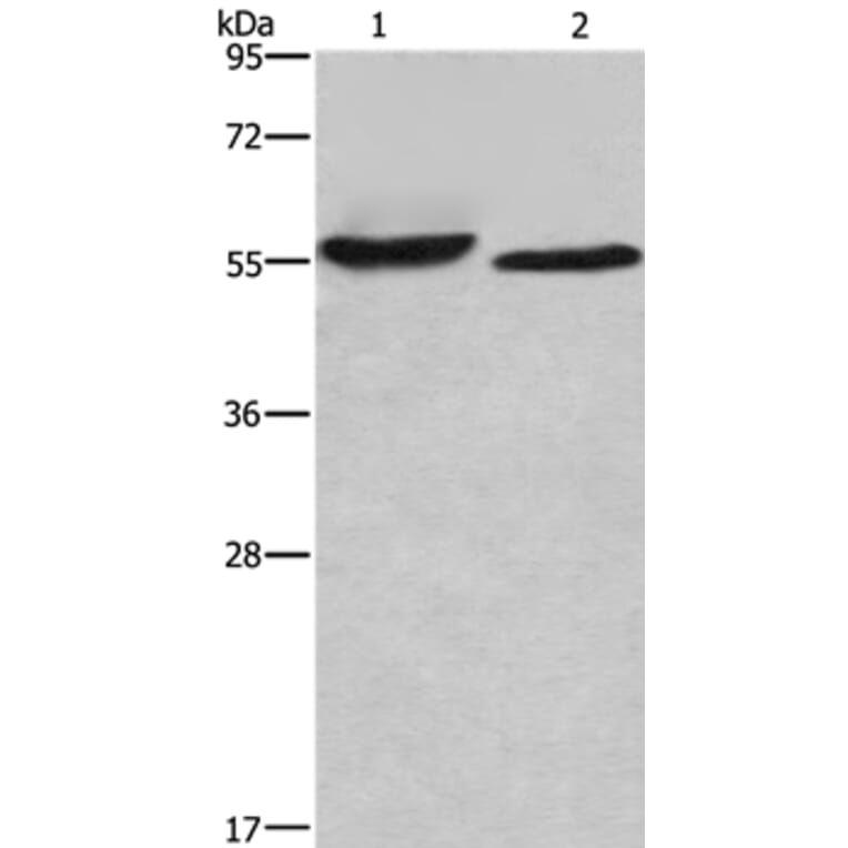 AMIGO2 Antibody from Signalway Antibody (36094) - Antibodies.com