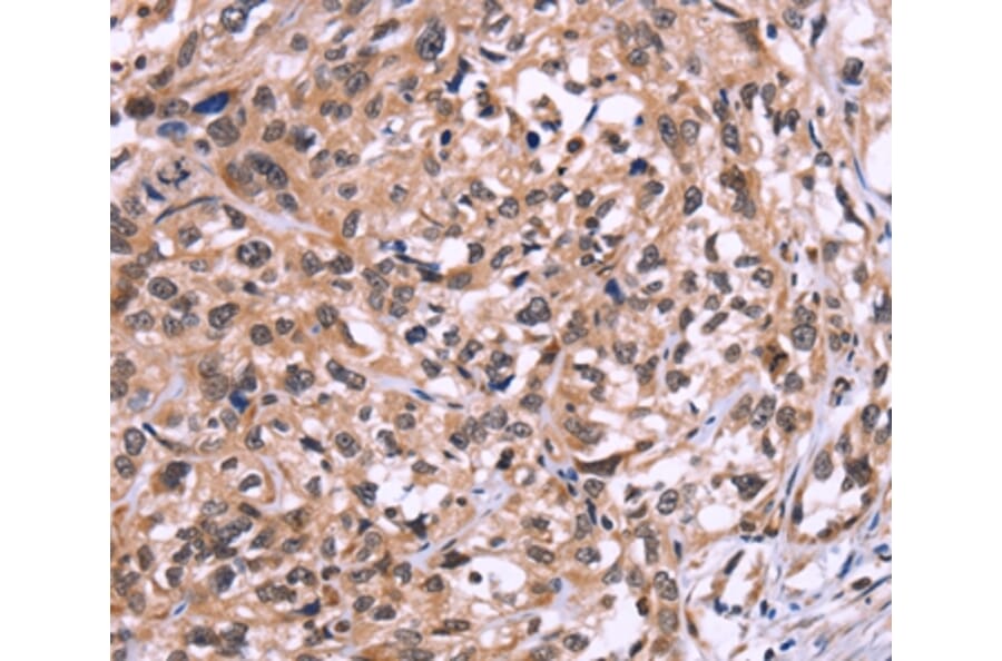 Immunohistochemistry - AMIGO2 Antibody from Signalway Antibody (36094) - Antibodies.com