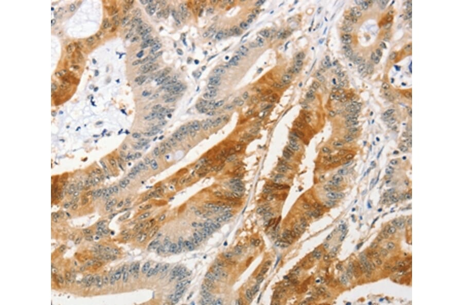Immunohistochemistry - ANAPC2 Antibody from Signalway Antibody (36111) - Antibodies.com