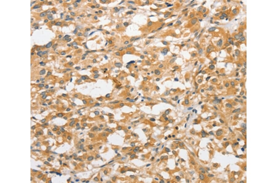 Immunohistochemistry - ANAPC5 Antibody from Signalway Antibody (36113) - Antibodies.com