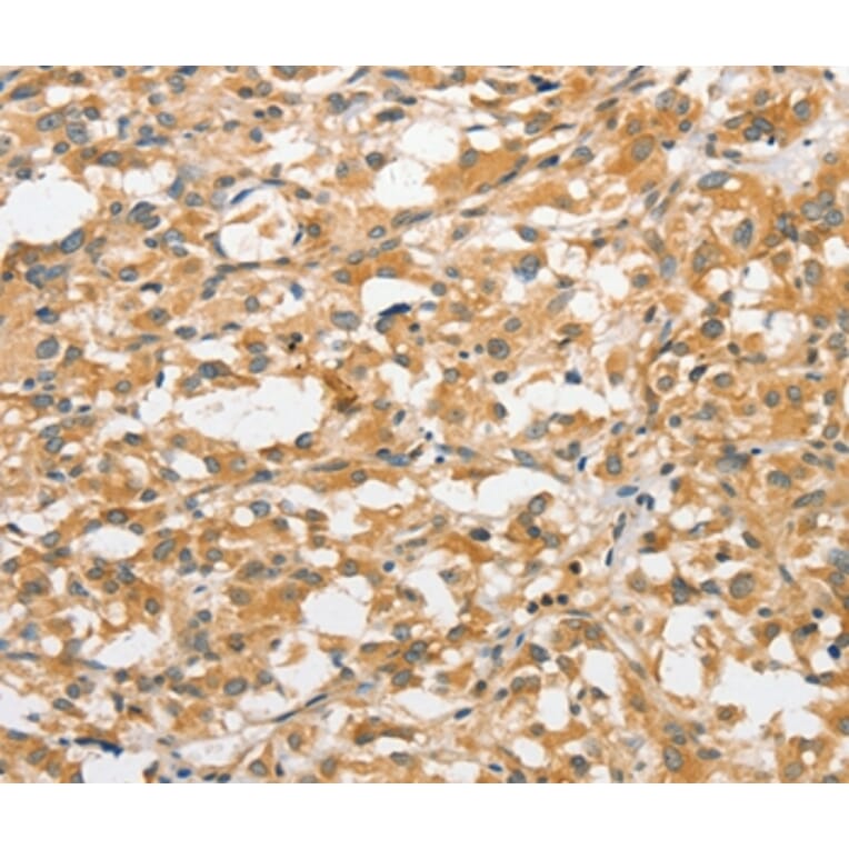 Immunohistochemistry - ANAPC5 Antibody from Signalway Antibody (36113) - Antibodies.com