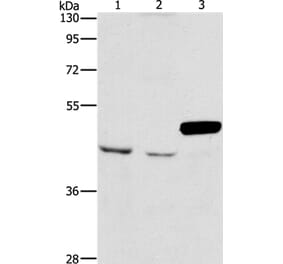 ARMCX3 Antibody from Signalway Antibody (36140) - Antibodies.com