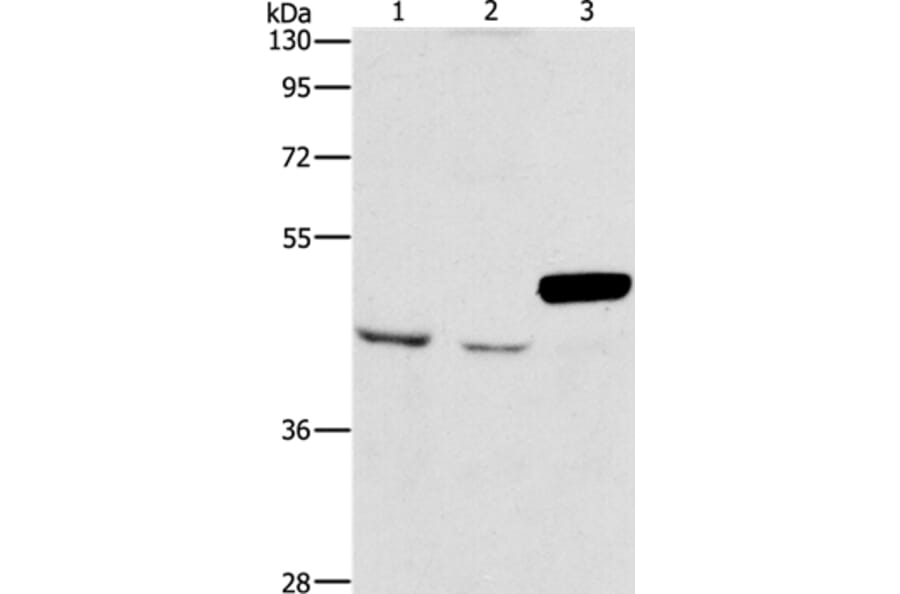 ARMCX3 Antibody from Signalway Antibody (36140) - Antibodies.com