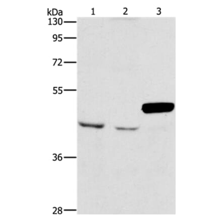 ARMCX3 Antibody from Signalway Antibody (36140) - Antibodies.com