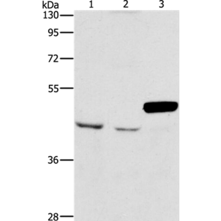 ARMCX3 Antibody from Signalway Antibody (36140) - Antibodies.com