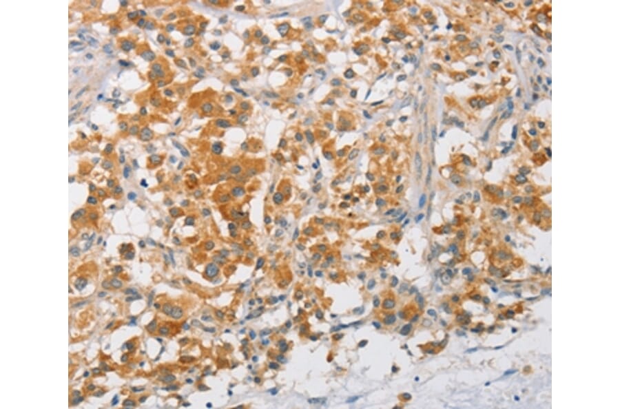Immunohistochemistry - ARMCX3 Antibody from Signalway Antibody (36140) - Antibodies.com