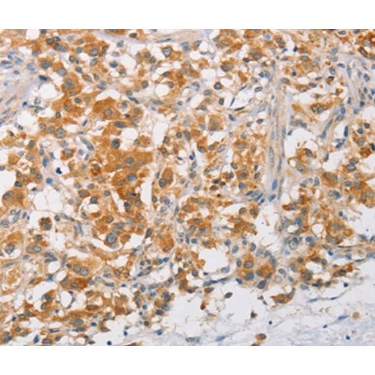 Immunohistochemistry - ARMCX3 Antibody from Signalway Antibody (36140) - Antibodies.com