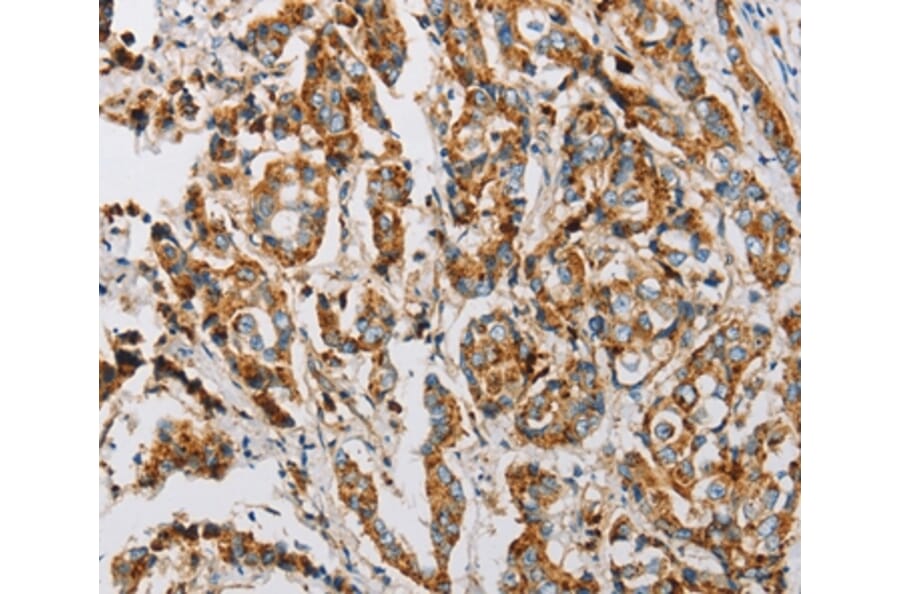 Immunohistochemistry - IFITM3 Antibody from Signalway Antibody (36149) - Antibodies.com