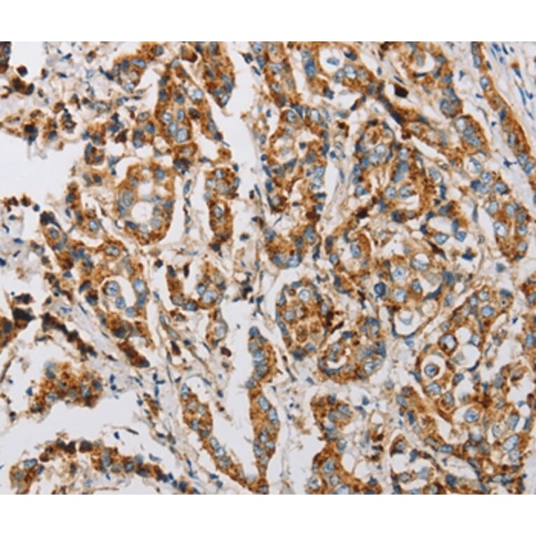 Immunohistochemistry - IFITM3 Antibody from Signalway Antibody (36149) - Antibodies.com