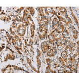 Immunohistochemistry - IFITM3 Antibody from Signalway Antibody (36149) - Antibodies.com