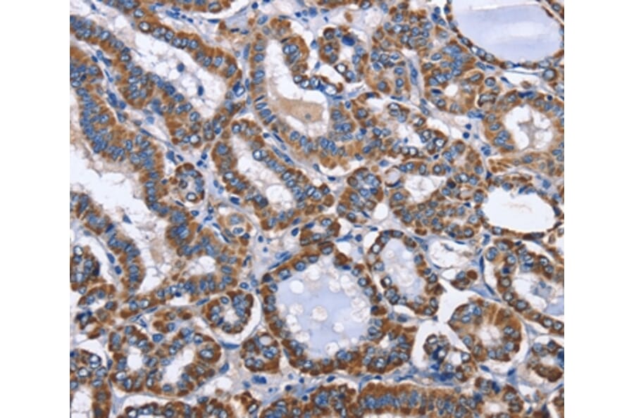Immunohistochemistry - INTS10 Antibody from Signalway Antibody (36159) - Antibodies.com