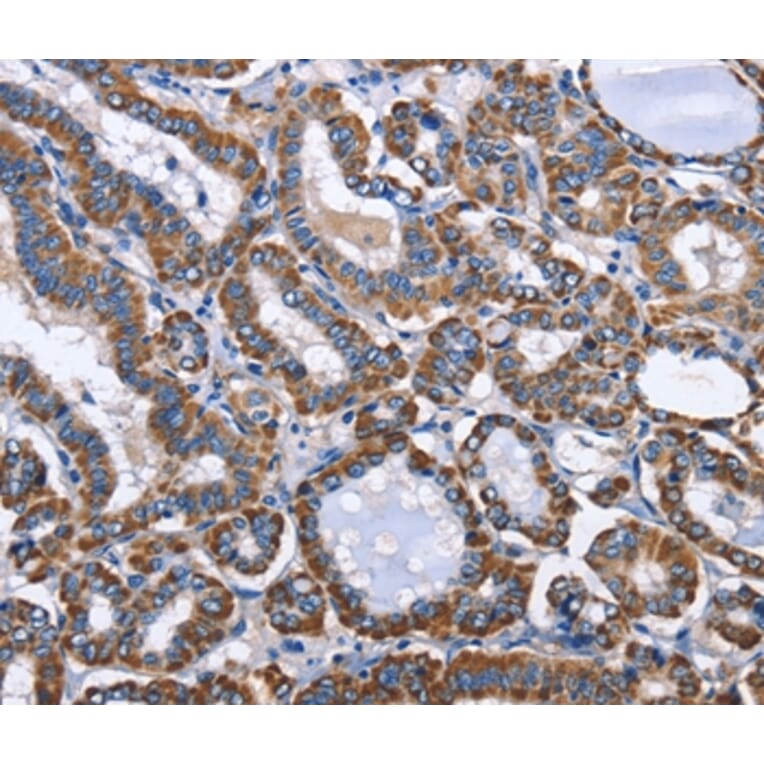 Immunohistochemistry - INTS10 Antibody from Signalway Antibody (36159) - Antibodies.com