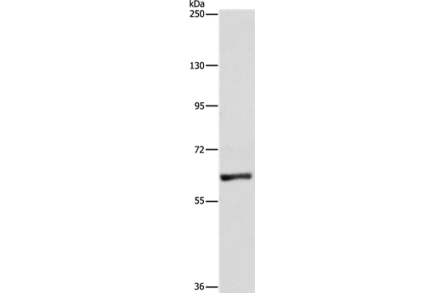 UBQLN1 Antibody from Signalway Antibody (36171) - Antibodies.com