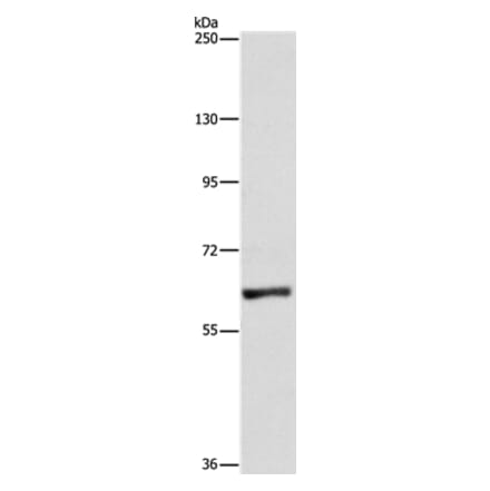 UBQLN1 Antibody from Signalway Antibody (36171) - Antibodies.com