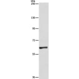 UBQLN1 Antibody from Signalway Antibody (36171) - Antibodies.com