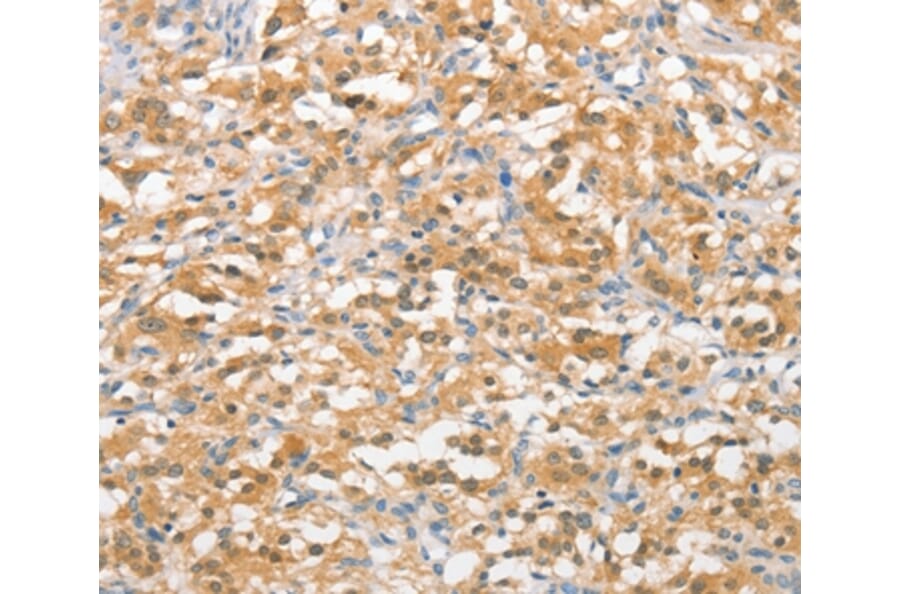 Immunohistochemistry - UBQLN1 Antibody from Signalway Antibody (36171) - Antibodies.com