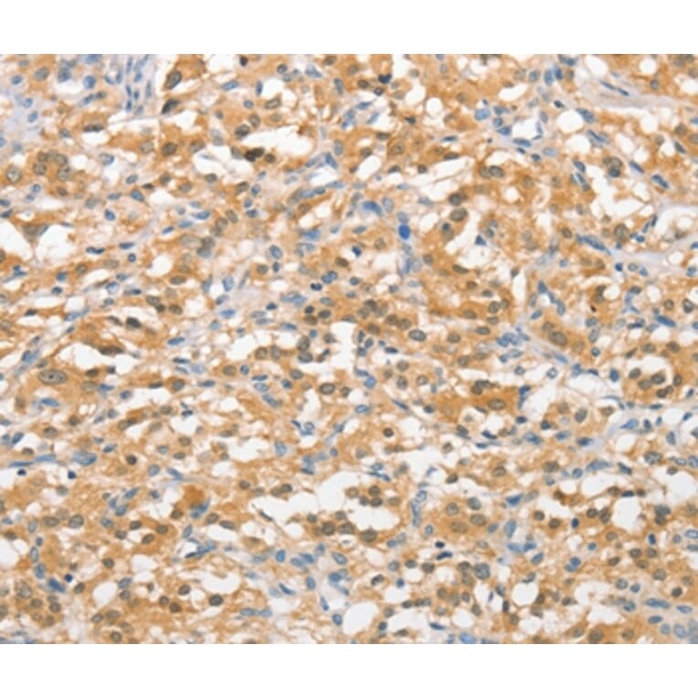 Immunohistochemistry - UBQLN1 Antibody from Signalway Antibody (36171) - Antibodies.com