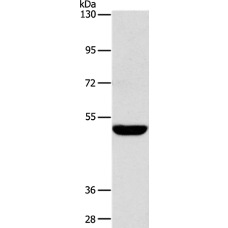SPTLC1 Antibody from Signalway Antibody (36175) - Antibodies.com