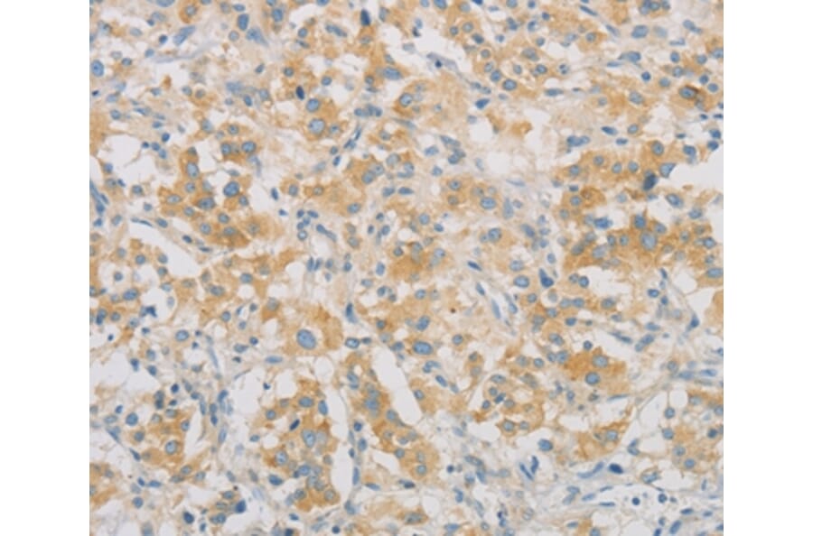 Immunohistochemistry - SPTLC1 Antibody from Signalway Antibody (36175) - Antibodies.com