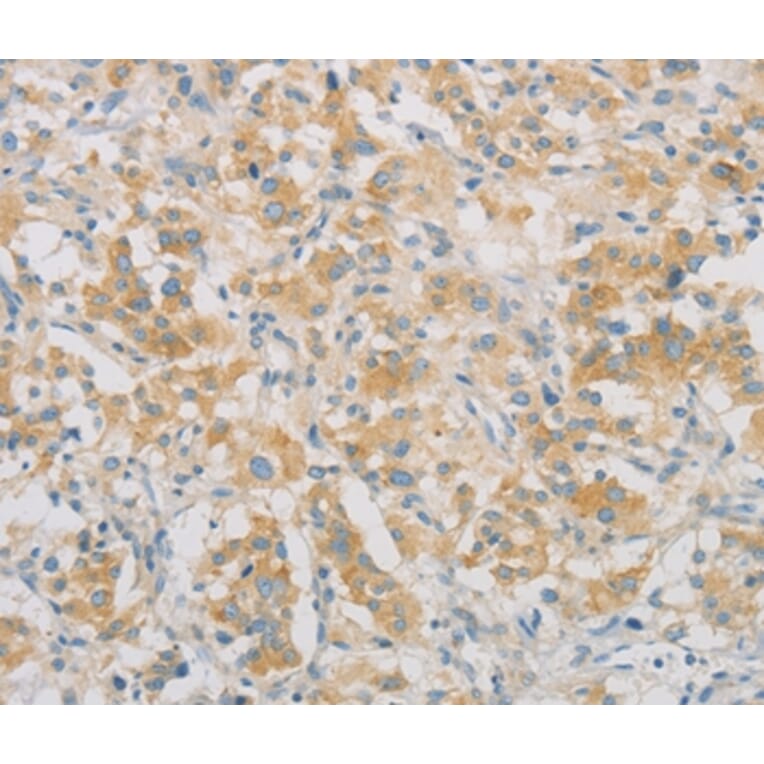 Immunohistochemistry - SPTLC1 Antibody from Signalway Antibody (36175) - Antibodies.com