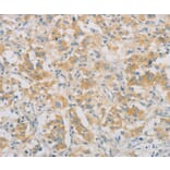 Immunohistochemistry - SPTLC1 Antibody from Signalway Antibody (36175) - Antibodies.com