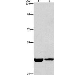 CSNK1E Antibody from Signalway Antibody (36232) - Antibodies.com