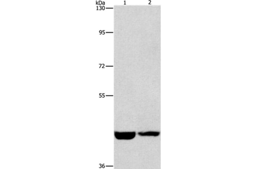 CSNK1E Antibody from Signalway Antibody (36232) - Antibodies.com