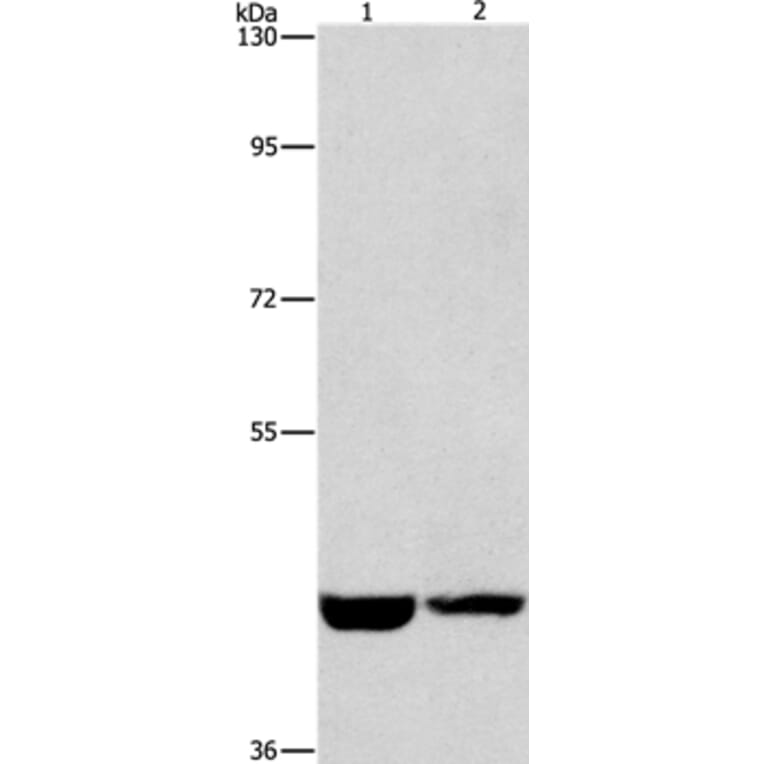 CSNK1E Antibody from Signalway Antibody (36232) - Antibodies.com
