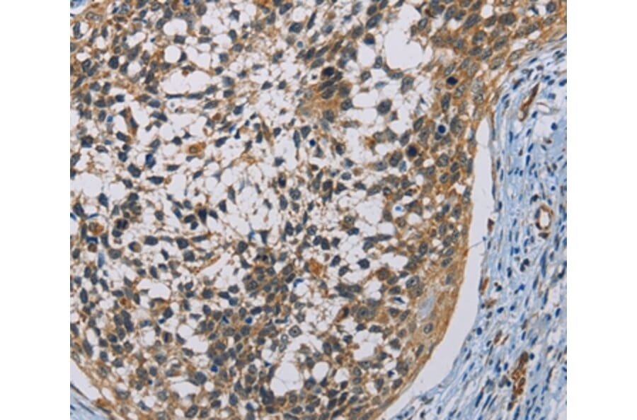 Immunohistochemistry - CSNK1E Antibody from Signalway Antibody (36232) - Antibodies.com