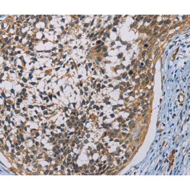 Immunohistochemistry - CSNK1E Antibody from Signalway Antibody (36232) - Antibodies.com