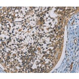 Immunohistochemistry - CSNK1E Antibody from Signalway Antibody (36232) - Antibodies.com