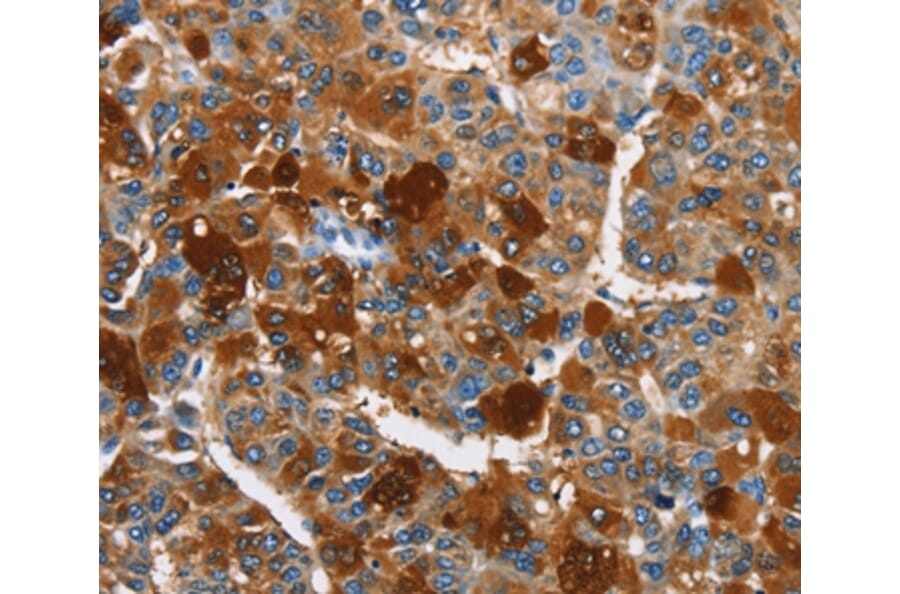 Immunohistochemistry - ARMCX2 Antibody from Signalway Antibody (36262) - Antibodies.com