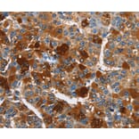 Immunohistochemistry - ARMCX2 Antibody from Signalway Antibody (36262) - Antibodies.com