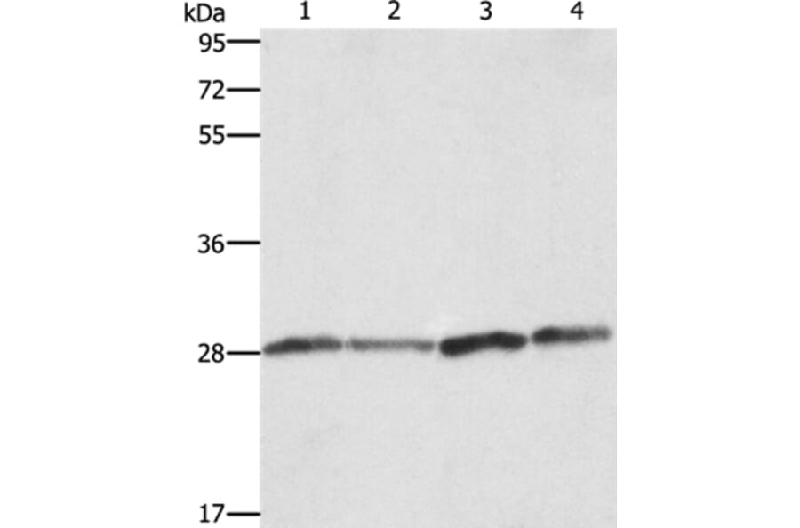 BCAP31 Antibody from Signalway Antibody (36275) - Antibodies.com