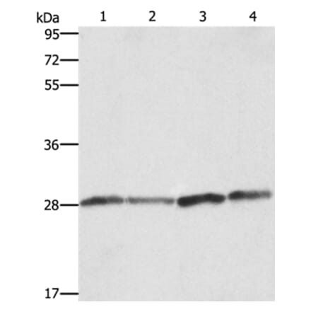 BCAP31 Antibody from Signalway Antibody (36275) - Antibodies.com