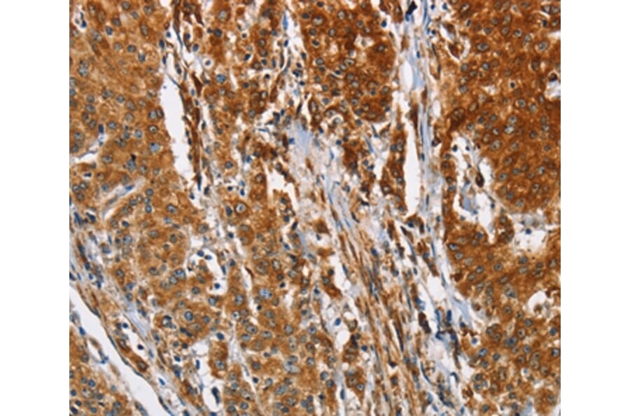 Immunohistochemistry - BCAP31 Antibody from Signalway Antibody (36275) - Antibodies.com