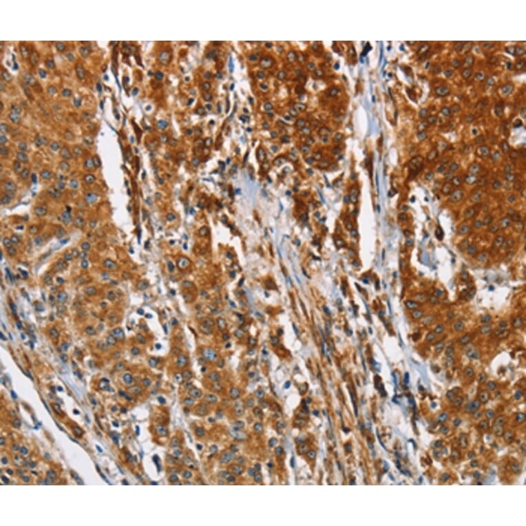 Immunohistochemistry - BCAP31 Antibody from Signalway Antibody (36275) - Antibodies.com