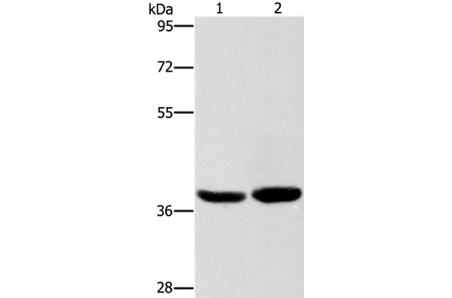 CAB39L Antibody from Signalway Antibody (36295) - Antibodies.com