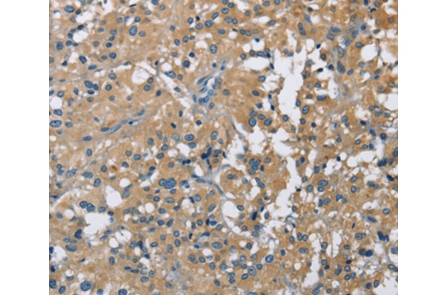 Immunohistochemistry - CAB39L Antibody from Signalway Antibody (36295) - Antibodies.com