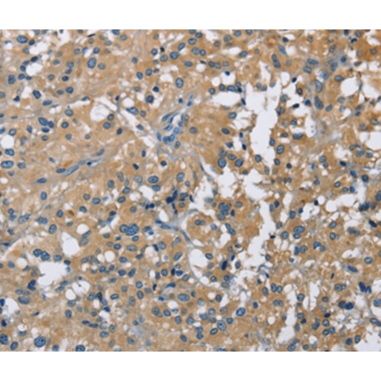 Immunohistochemistry - CAB39L Antibody from Signalway Antibody (36295) - Antibodies.com