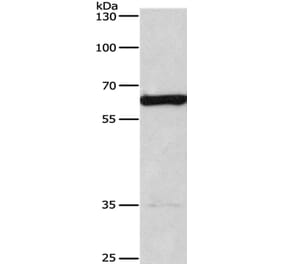 CACNB1 Antibody from Signalway Antibody (36297) - Antibodies.com