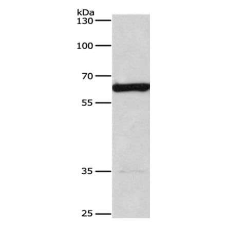 CACNB1 Antibody from Signalway Antibody (36297) - Antibodies.com