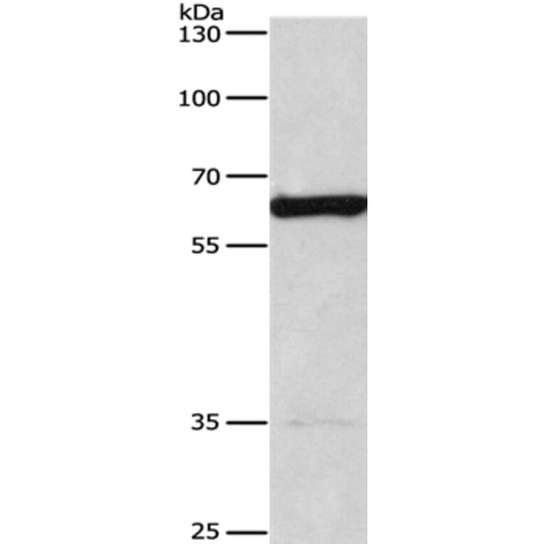 CACNB1 Antibody from Signalway Antibody (36297) - Antibodies.com