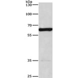 CACNB1 Antibody from Signalway Antibody (36297) - Antibodies.com