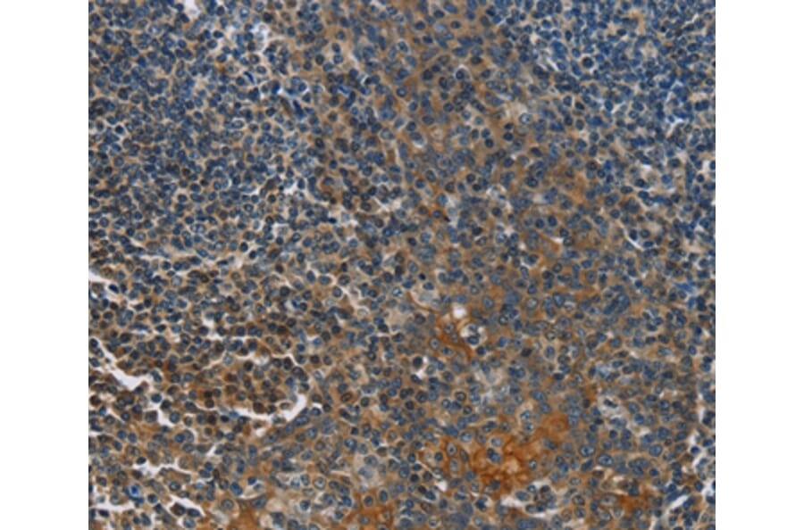 Immunohistochemistry - CACNB1 Antibody from Signalway Antibody (36297) - Antibodies.com