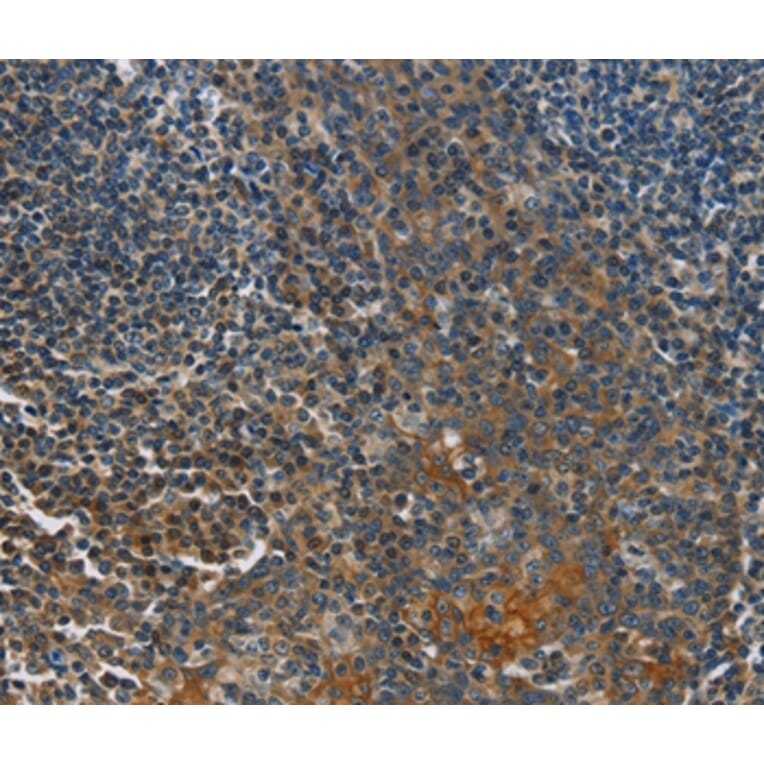 Immunohistochemistry - CACNB1 Antibody from Signalway Antibody (36297) - Antibodies.com