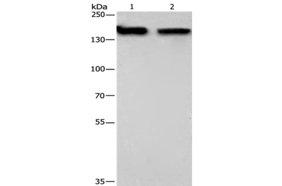 NCAPD2 Antibody from Signalway Antibody (36305) - Antibodies.com